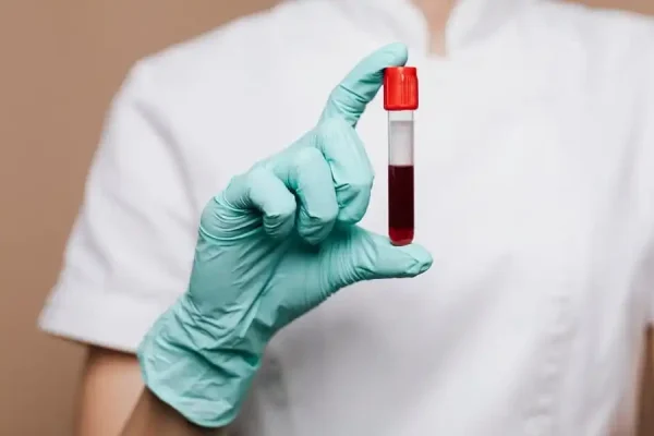 Your blood type may predict risk of stroke before 60: Study